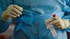 تطوير اختبار مسحة الأنف للكشف عن كورونا في المنزل