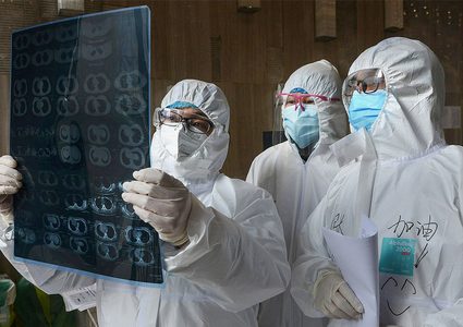 بعد طول انتظار.. علماء يستعدون لتقديم تقرير "أصل كورونا"