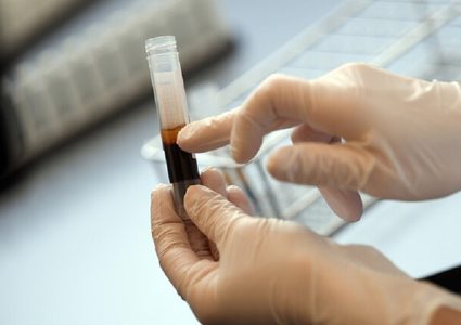 منظمة الصحة العالمية تحدد 4 احتمالات لانتقال فيروس كورونا للبشر