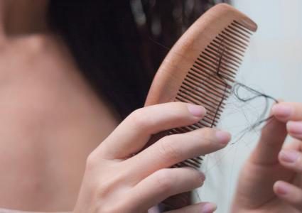 دراسة: الإجهاد من الأسباب الرئيسية في تساقط الشعر