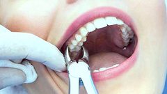 كيف يكون علاج الضرس في نهار رمضان؟