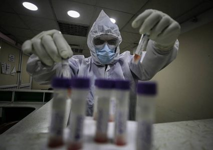 30 وفاة و1529 إصابة جديدة بفيروس "كورونا"