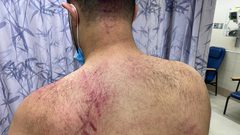 أنصار حاخام يهودي في يافا يعتدون على أهالي المدينة بسبب تظاهرهم