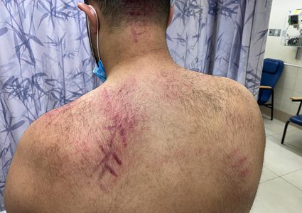 أنصار حاخام يهودي في يافا يعتدون على أهالي المدينة بسبب تظاهرهم