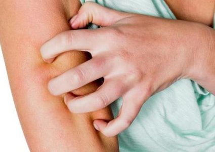 فصيلة دمك قد تحولك الى وليمة للبعوض