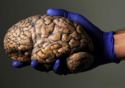 كيف يصل فيروس كورونا إلى الدماغ؟