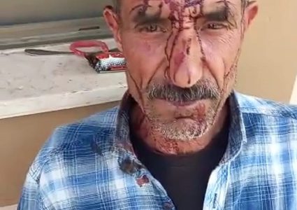 جنين: مستوطنون يعتدون على راعي أغنام ويصيبونه بجروح