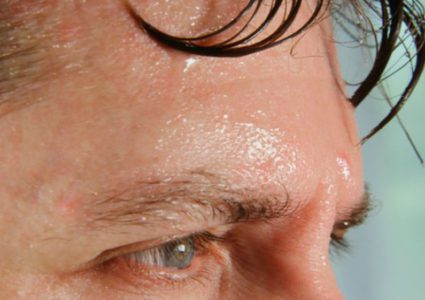 العرق البارد يشير إلى ضرورة مراجعة الطبيب