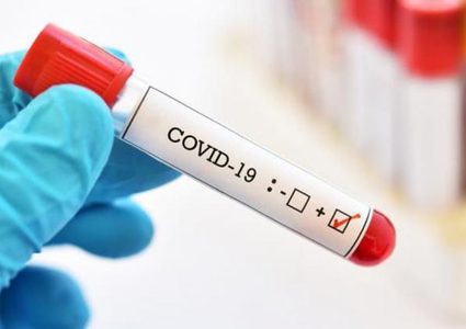 عالمياً:3 ملايين و285 ألف وفاة و157 مليونا و577 ألف إصابة بكورونا