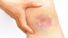 6 نصائح لإفطار مريض الهيموفيليا في رمضان