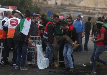 قلقيلية: إصابة بالرصاص الحي و تسعة بالمطاط والعشرات بالاختناق