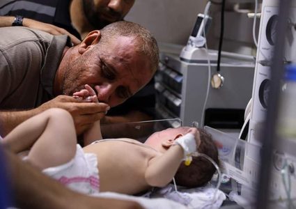 الفلسطيني محمد الحديدي يقبل يد طفله الناجي الوحيد من مجـزرة الشاطئ في غزة والتي راح ضحيتها 10 شهداء بينهم اطفال ونساء