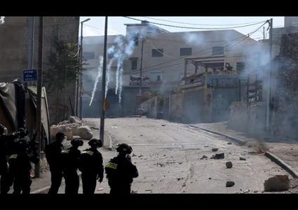 الصحة: 21 شهيدا بينهم طفل و 3728 جريحا في الضفة خلال المواجهات