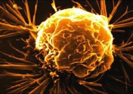 دراسة: السمنة تحميك من الوفاة بسبب الالتهابات البكتيرية