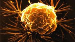 دراسة: السمنة تحميك من الوفاة بسبب الالتهابات البكتيرية