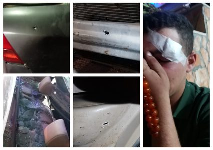 إصابة 3 مواطنين برضوض إثر اعتداء جنود الاحتلال عليهم قرب يبرود