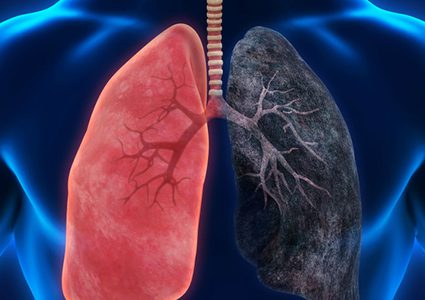 خبر سار.. علاج أميركي فعال لسرطان الرئة