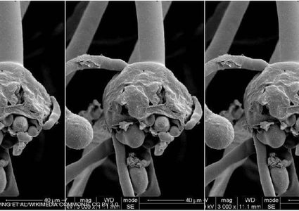 الصحة المصرية تكشف حقيقة الإصابات بـ"الفطر الأسود"