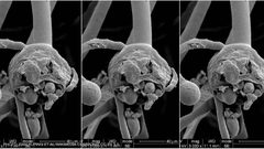 الصحة المصرية تكشف حقيقة الإصابات بـ"الفطر الأسود"