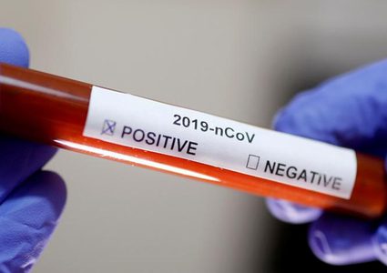 وفاتان و183 إصابة جديدة بكورونا خلال الـ24 ساعة الماضية