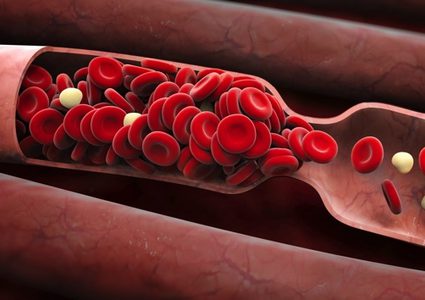 أعراض رئيسية يمكنها كشف الاصابة بتجلطات الدم