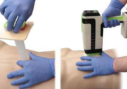 في "دقيقة واحدة".. جهاز مبتكر يوقف نزيف الجروح