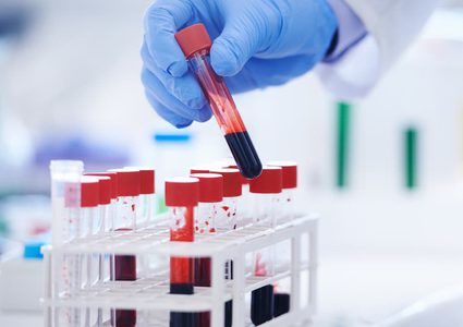 خطة العلماء لمواجهة أخطر الأمراض.. 3 أولويات يتصدرها السرطان