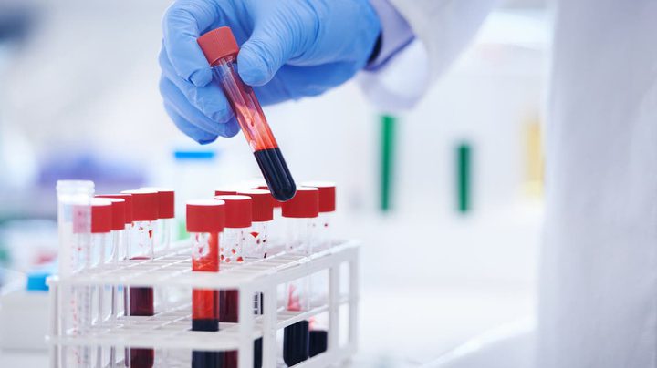 خطة العلماء لمواجهة أخطر الأمراض.. 3 أولويات يتصدرها السرطان