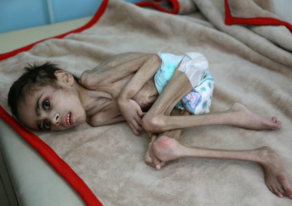 "أوكسفام": 11 شخصا في العالم يموتون جوعا كل دقيقة