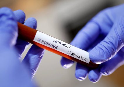 الصحة:وفاة و66 إصابة جديدة بفيروس "كورونا"