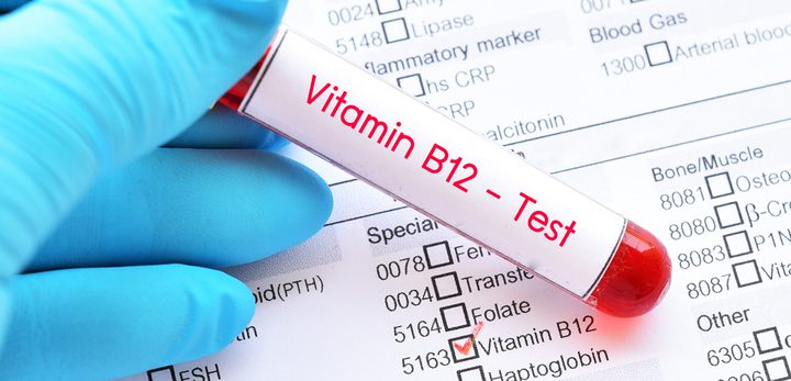 أبرز الأعراض العصبية التي يسببها نقص فيتامين b12