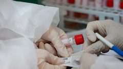 3 وفيات 1788 إصابة جديدة بفيروس "كورونا" و343 حالة تعافٍ