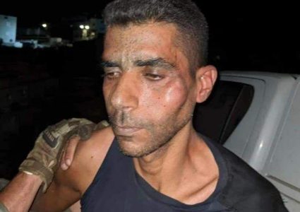 نقل الأسير زكريا الزبيدي إلى مستشفى رمبام لتلقي العلاج