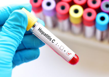 ما هي الأعراض التي تكشف إصابتك بفيروس سي ؟