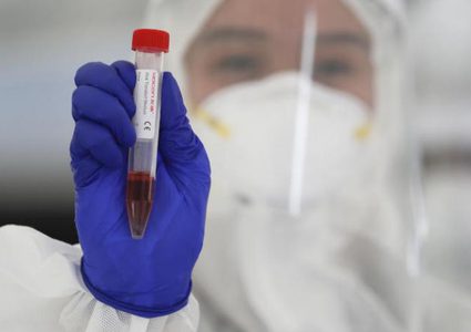 منها كوكاكولا..مشروبات يؤثر تناولها على صحة نتائج اختبار كورونا