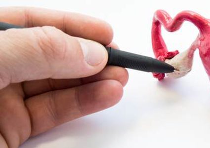 لُبَّادة تُوضّح العلاقة بين متلازمة تكيس المبايض ومشاكل البشرة