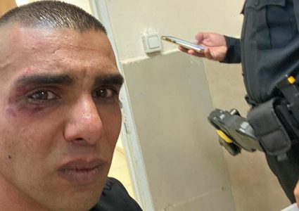 مستوطنون يعتدون بالضرب على شاب فلسطيني في الخضيرة