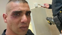 مستوطنون يعتدون بالضرب على شاب فلسطيني في الخضيرة