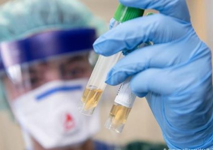 أكثر من 4 ملايين وفاة و235 مليوناً و472 ألف اصابة بكورونا عالمياً