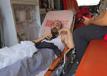 الاحتلال يعتدي على مواطنين في سلوان ويصيب أحدهم برضوض