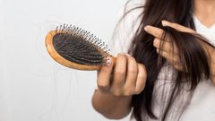 لا الوراثة ولا الشيخوخة.. هذا سبب تساقط الشعر!