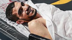 الوضع الصحي للأسير شوامرة مستقر لكنه بحاجة لرعاية حثيثة