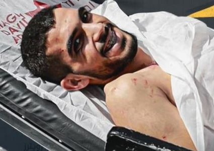 الوضع الصحي للأسير شوامرة مستقر لكنه بحاجة لرعاية حثيثة