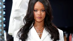 فنانون أمّنوا على أعضائهم بمبالغ خيالية