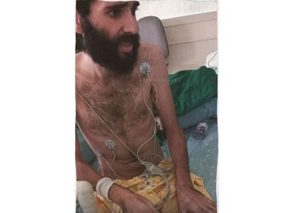 صور مؤلمة للأسير مقداد القواسمي المضرب عن الطعام لأكثر من 3 أشهر