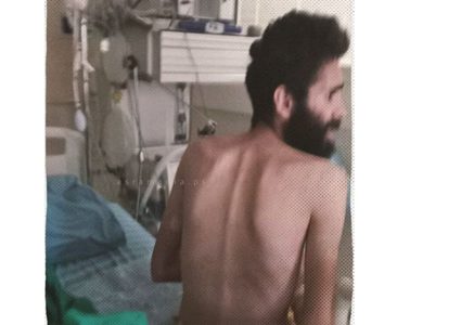صور مؤلمة للأسير مقداد القواسمي المضرب عن الطعام لأكثر من 3 أشهر