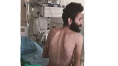 صور مؤلمة للأسير مقداد القواسمي المضرب عن الطعام لأكثر من 3 أشهر