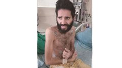 صور مؤلمة للأسير مقداد القواسمي المضرب عن الطعام لأكثر من 3 أشهر