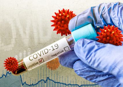 دراسة: النساء الحوامل بذكور أكثر عرضة للإصابة بكورونا