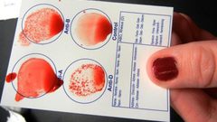 دراسة: فصيلة الدم "AB" تزيد خطر الاصابة بأمراض السرطان